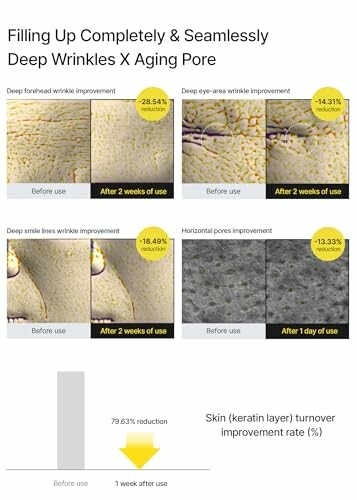 Resultados de reducción de arrugas profundas en dos semanas.