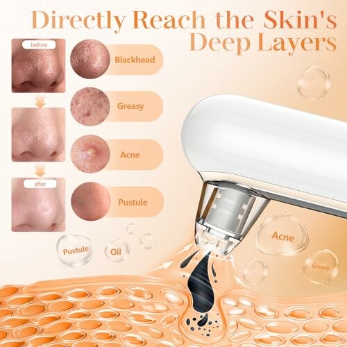 Dispositivo de cuidado de la piel eliminando impurezas.